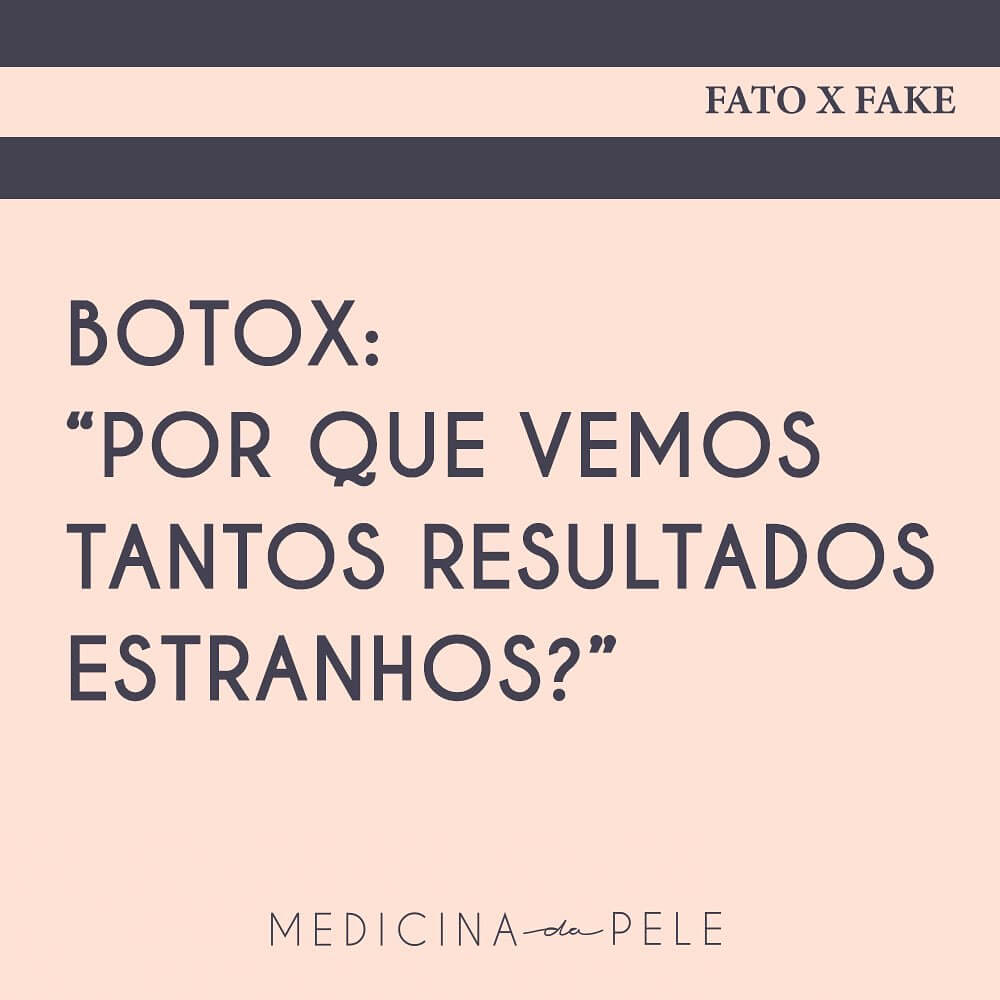 Botox: “Por que vemos tantos resultados estranhos?”